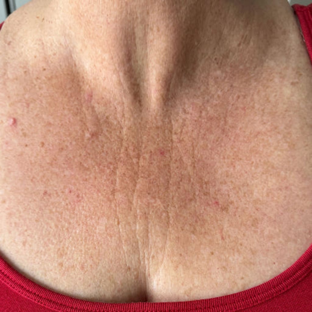 Velora Wrinkle Retreat Pro Face Mask